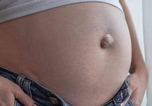 Göbek fıtığının nedenleri, belirtileri ve tedavi yöntemleri​