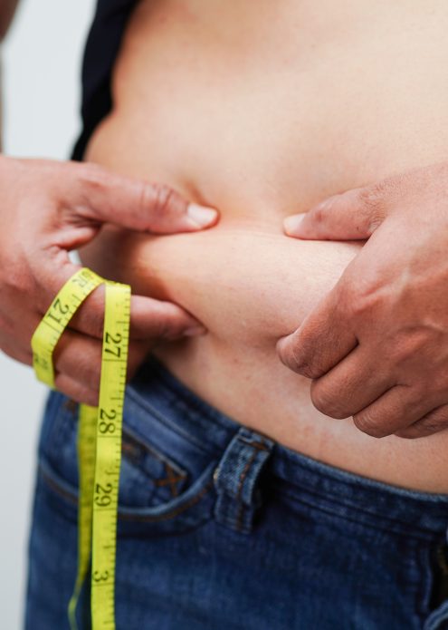 obezite cerrahisi şeker ameliyatı