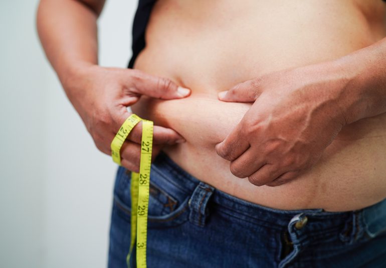 obezite cerrahisi şeker ameliyatı