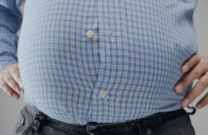 obezite cerrahisi şeker ameliyatı