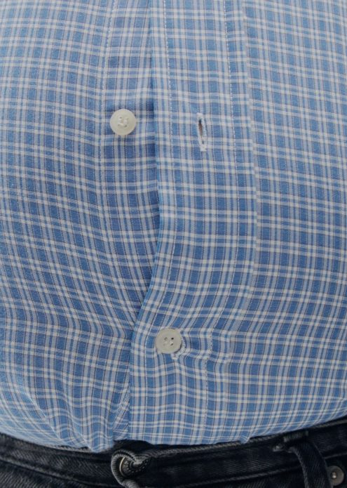 obezite cerrahisi şeker ameliyatı