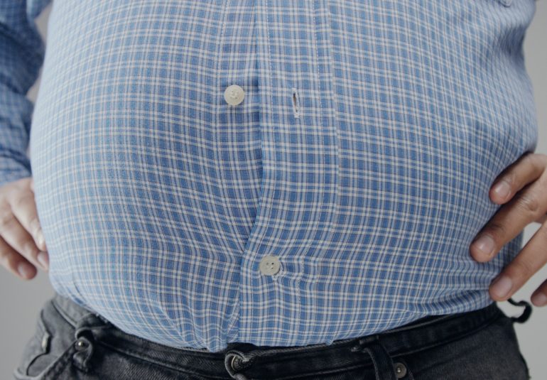 obezite cerrahisi şeker ameliyatı